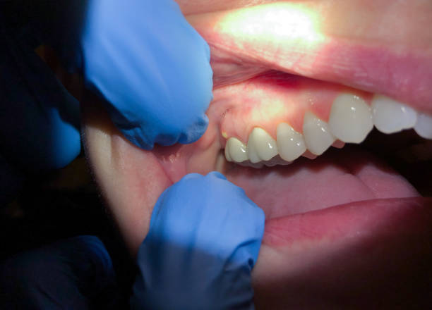 Best Emergency Treatment for Toothache in Brock Hall, MD