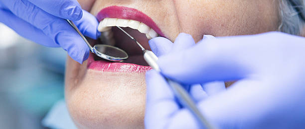 Best Emergency Root Canal Treatment in Brock Hall, MD